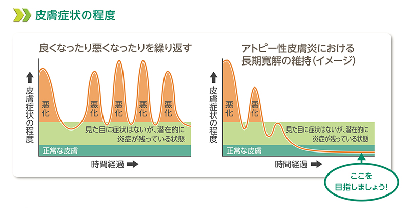 アトピー性皮膚炎の皮膚症状の程度